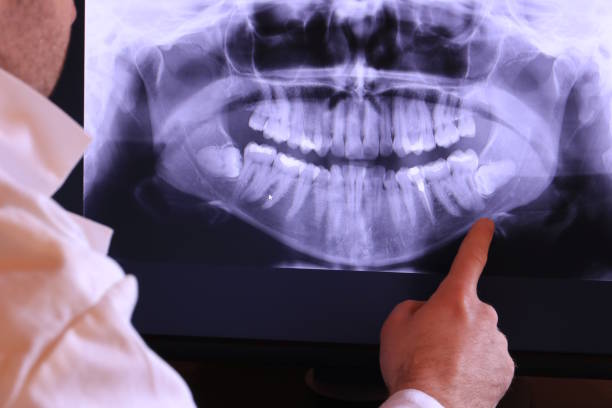 Best Pediatric Emergency Dentist in Kirkland, IL