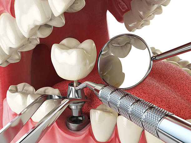 Best Emergency Treatment for Toothache in Kirkland, IL